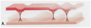 1-karboksiterapia-strii-po-korema-hansha-bedrata-laser-clinic-paris