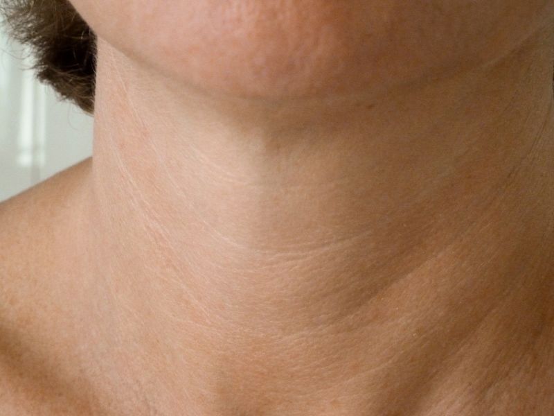 lipokontur md 1-1|lipokontur md 1-2