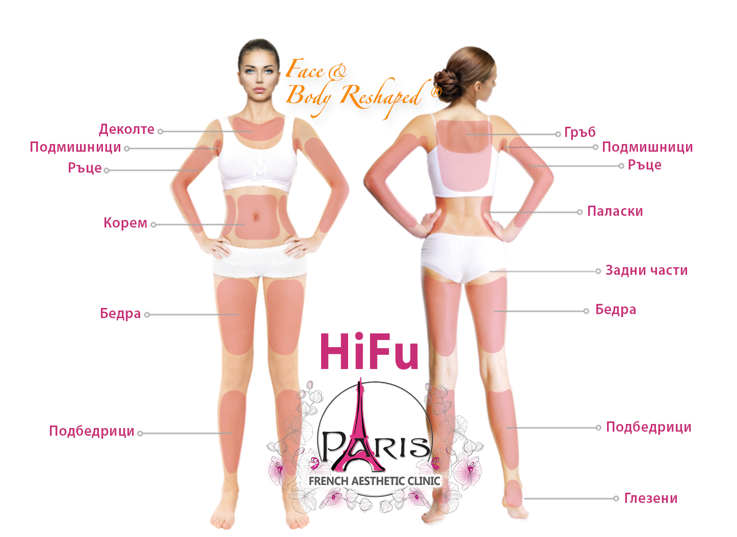 Зони на третиране HIFU Body Reshaped® НЕХИРУРГИЧЕН SMAS ЛИФТИНГ НА ТЯЛО с Високо интензивен фокусиран ултразвук Хайфу (HIFU) в Лазер Клиник ПАРИЖ, гр. Варна