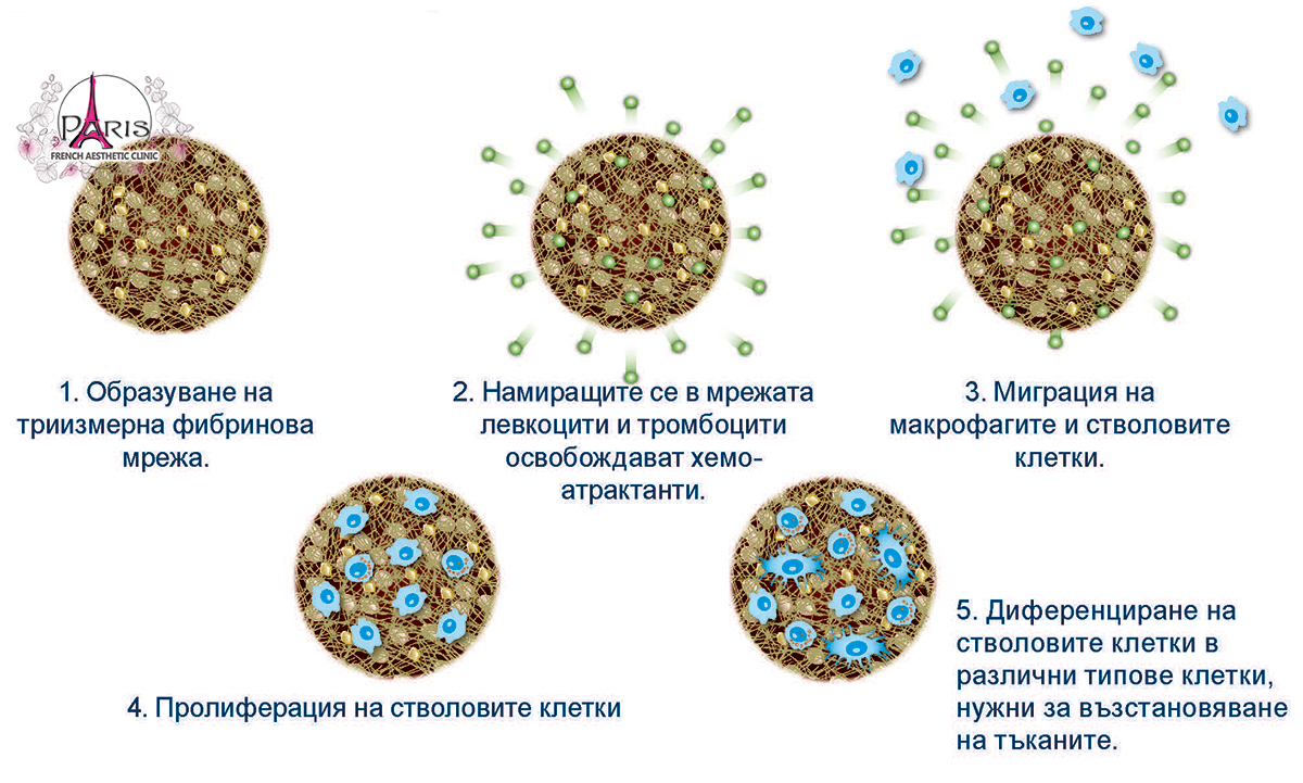 plasma-action